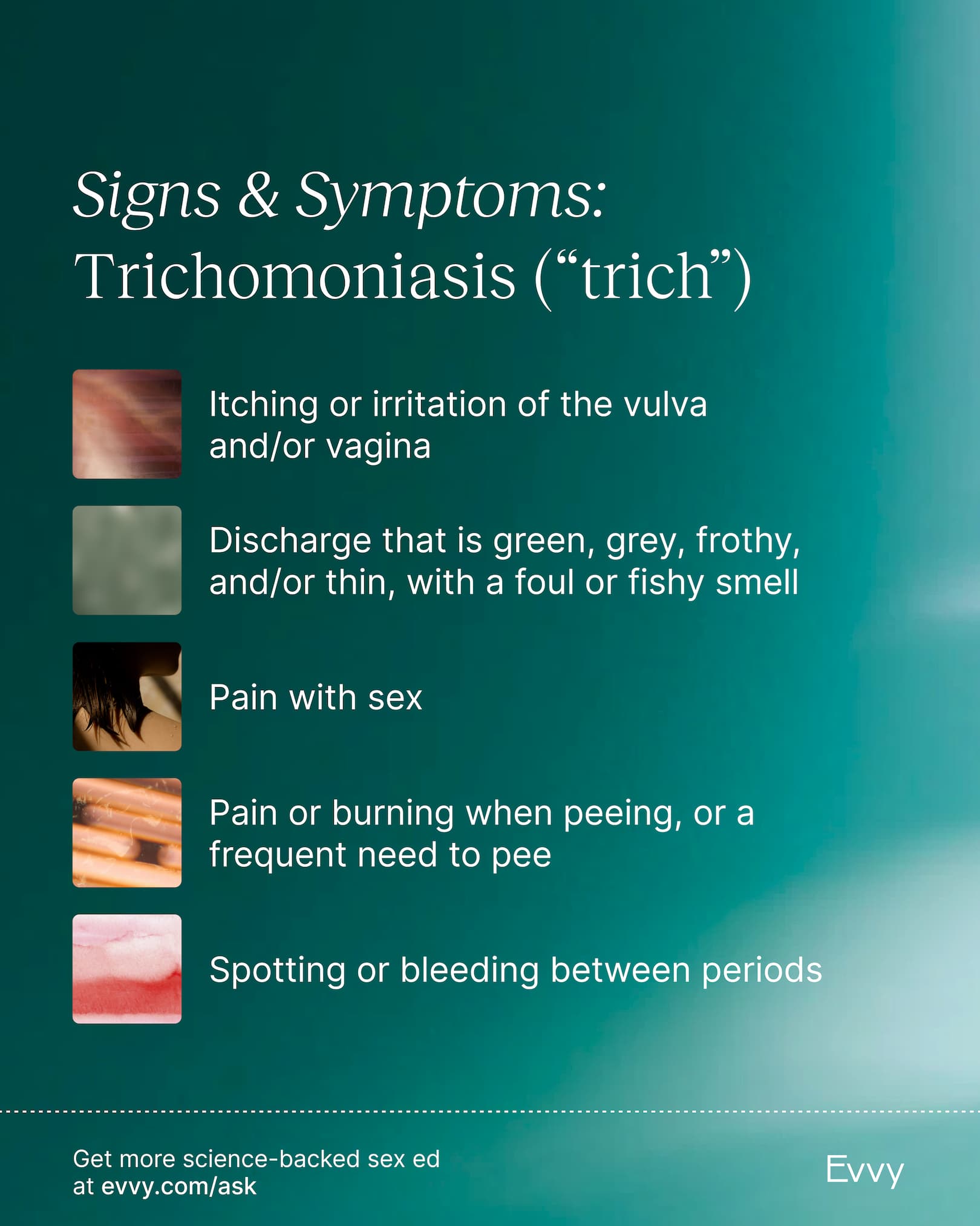 Trichomoniasis Discharge